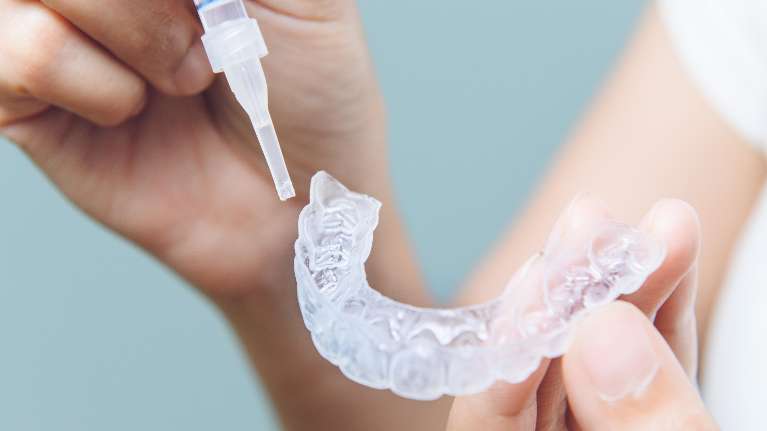Teeth whitening tray | Cosmetic dentistry Brentwood
